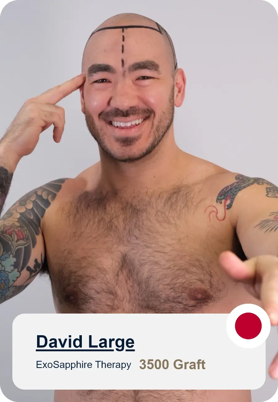 Treatments Hair Restoration Excellence You Can Trust
