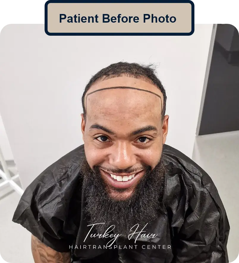 Group 461 Home Hair Restoration Excellence You Can Trust