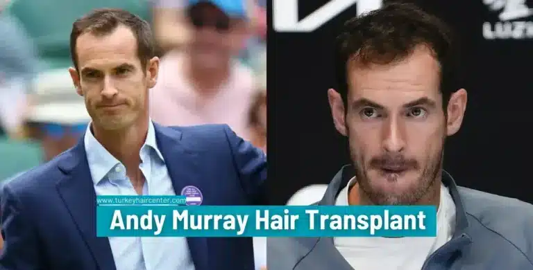 Andy-Murray-Hair-Transplant-7-1-768X390 Britain’s Number 1 Tennis Player Andy Murray’s Hair Transplant Hair Restoration Excellence You Can Trust