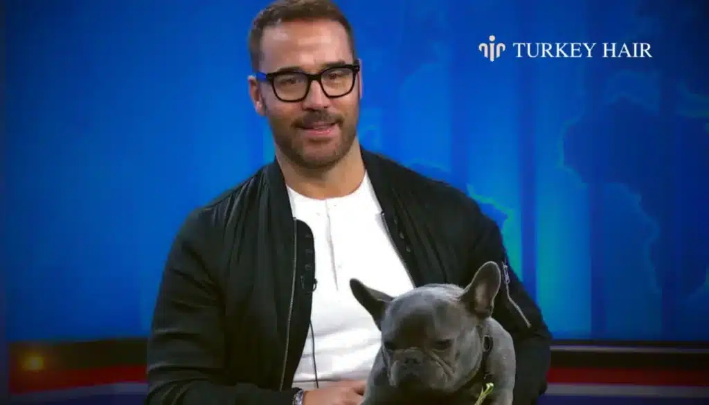 Could-Jeremy-Pivens-Results-Be-Replicated-Today-1344X768 Jeremy Piven Hair Transplant – Before And After Hair Restoration Excellence You Can Trust