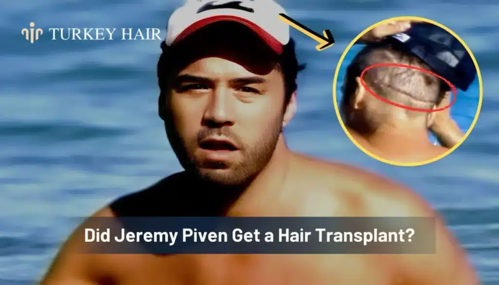 Did-Jeremy-Piven-Get-A-Hair-Transplant-1344X768 Jeremy Piven Hair Transplant – Before And After Hair Restoration Excellence You Can Trust