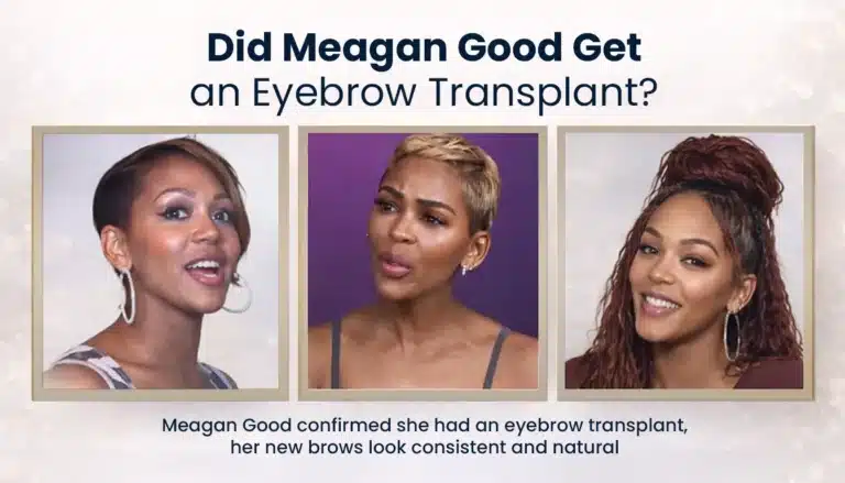 Did-Meagan-Good-Get-An-Eyebrow-Transplant-768X439 Meagan Good Eyebrow Transplant Before And After Hair Restoration Excellence You Can Trust
