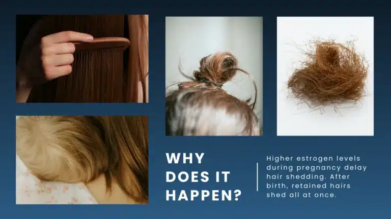 Hormonal-Changes-And-Their-Role-In-Postpartum-Hair-Loss-768X432 Postpartum Hair Loss Guide: Causes, Recovery And Healthy Regrowth Hair Restoration Excellence You Can Trust