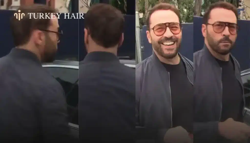 Jeremy-Piven-Hair-Transplant-–-Before-And-After-3-1344X768 Jeremy Piven Hair Transplant – Before And After Hair Restoration Excellence You Can Trust