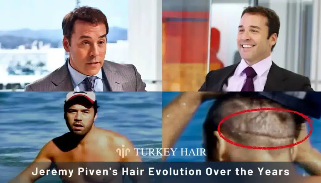 Jeremy-Pivens-Hair-Evolution-Over-The-Years-1344X768 Jeremy Piven Hair Transplant – Before And After Hair Restoration Excellence You Can Trust