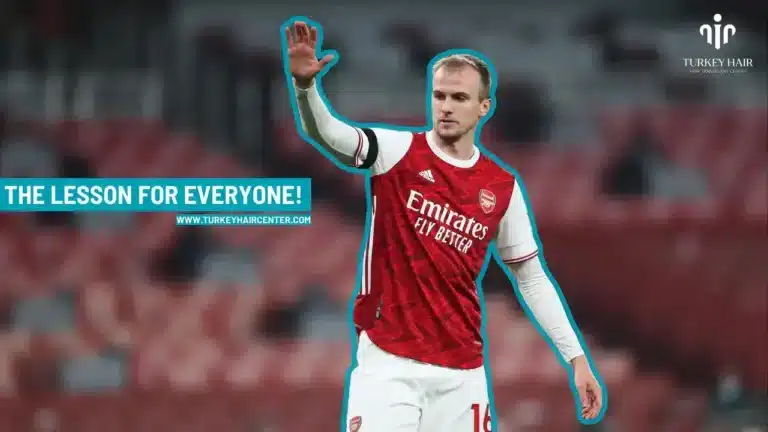 Rob-Holding-Hair-Transplant-3-1-1-768X432 Rob Holding Hair Transplant Hair Restoration Excellence You Can Trust