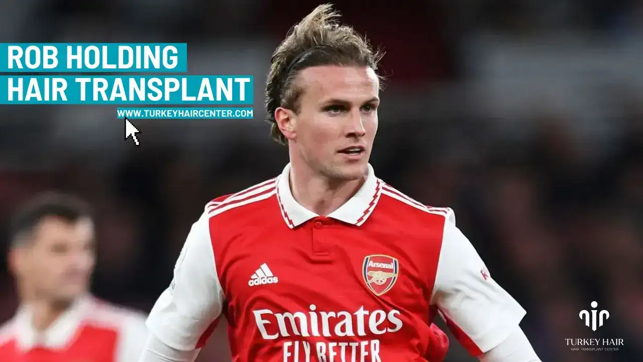Rob Holding Hair Transplant 1 Rob Holding Hair Transplant Hair Restoration Excellence You Can Trust