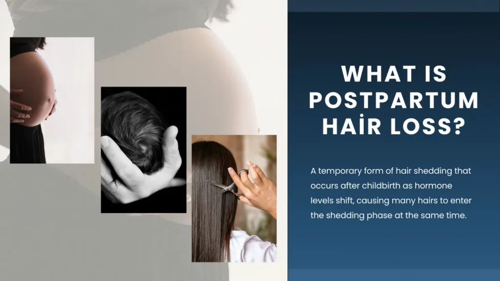 What-Is-Postpartum-Hair-Loss Postpartum Hair Loss Guide: Causes, Recovery And Healthy Regrowth Hair Restoration Excellence You Can Trust