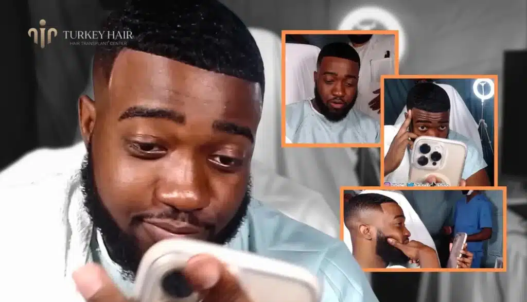 Youtuber-Jidion-Hair-Transplant-1024X587 Rumors About Jidion Hair Transplant Before And After Hair Restoration Excellence You Can Trust
