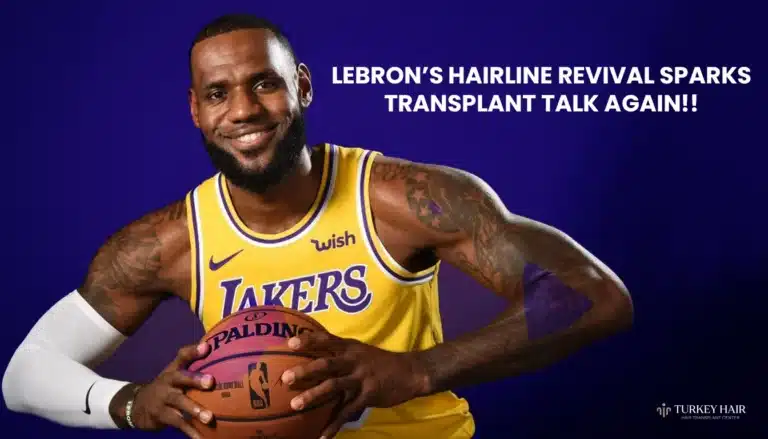 Lebron James Hairline Revival