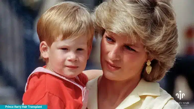 Prince-Harry-And-Princess-Diana-768X432 Prince Harry Hair Transplant: Before &Amp; After, Crown Density Analysis Hair Restoration Excellence You Can Trust