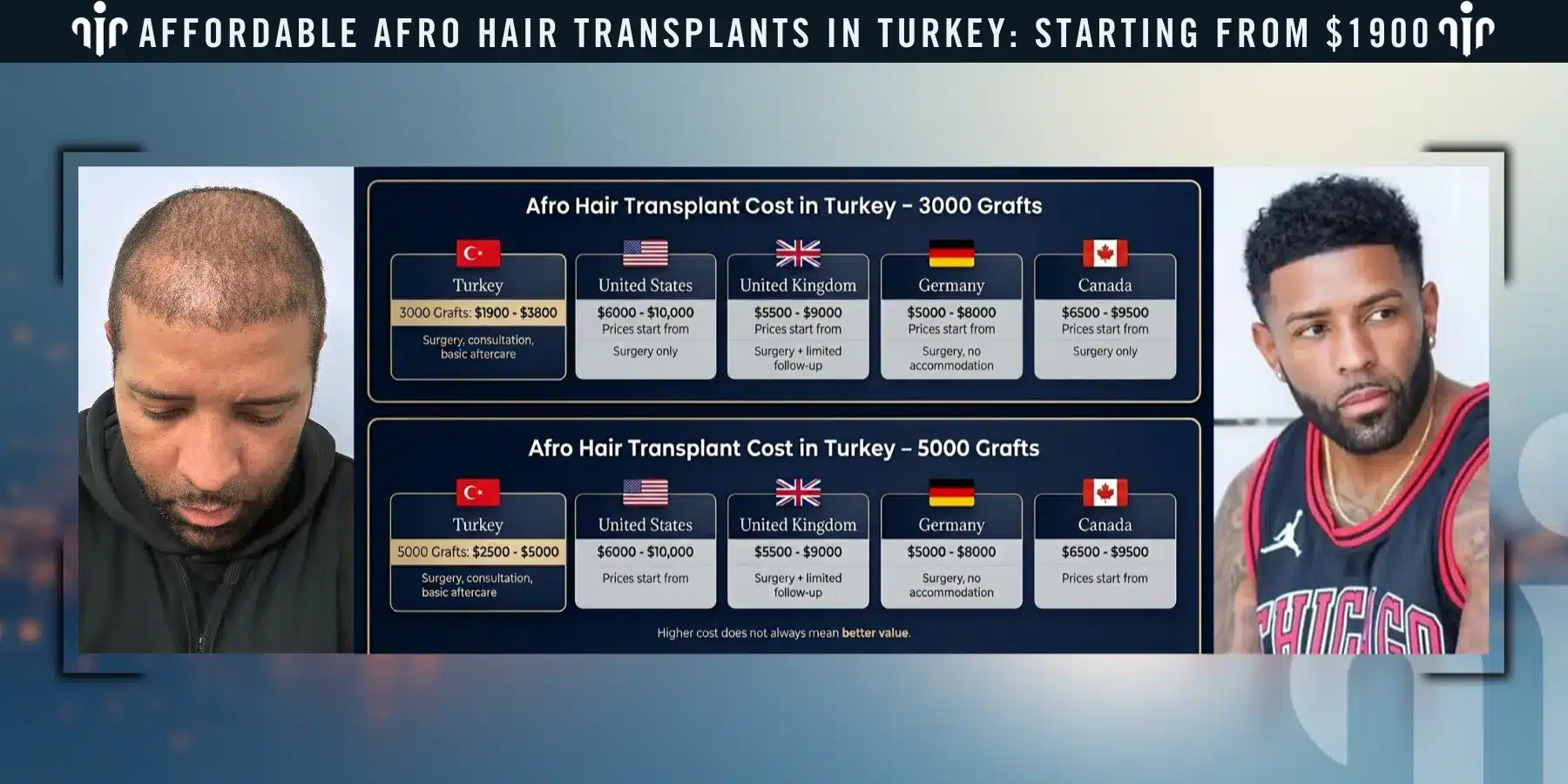 Afro Hair Transplant For Curly &Amp; Coily Hair 3 Afro Hair Transplant Cost Varies Depending On The Number Of Grafts, Hair Type, And The Complexity Of The Procedure.