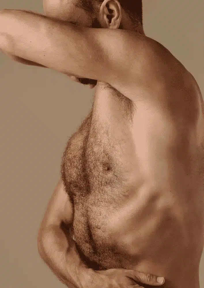 Body Hair Transplant