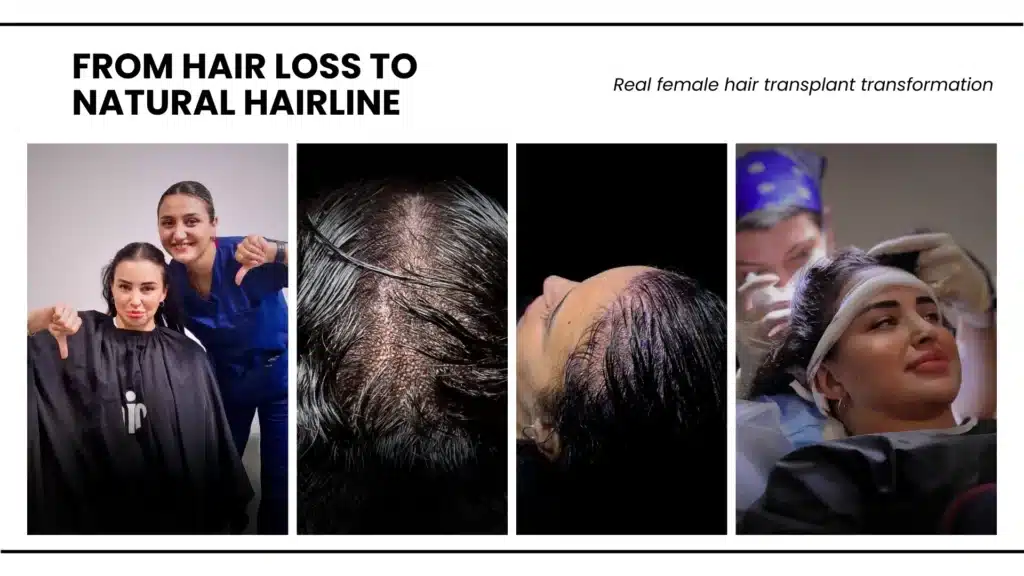 Common Hair Loss Issues In Female