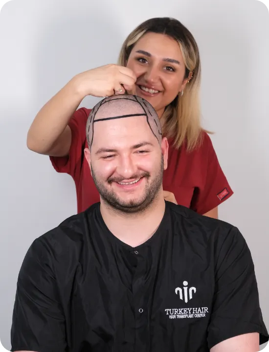 Dscf6161 Home Hair Restoration Excellence You Can Trust