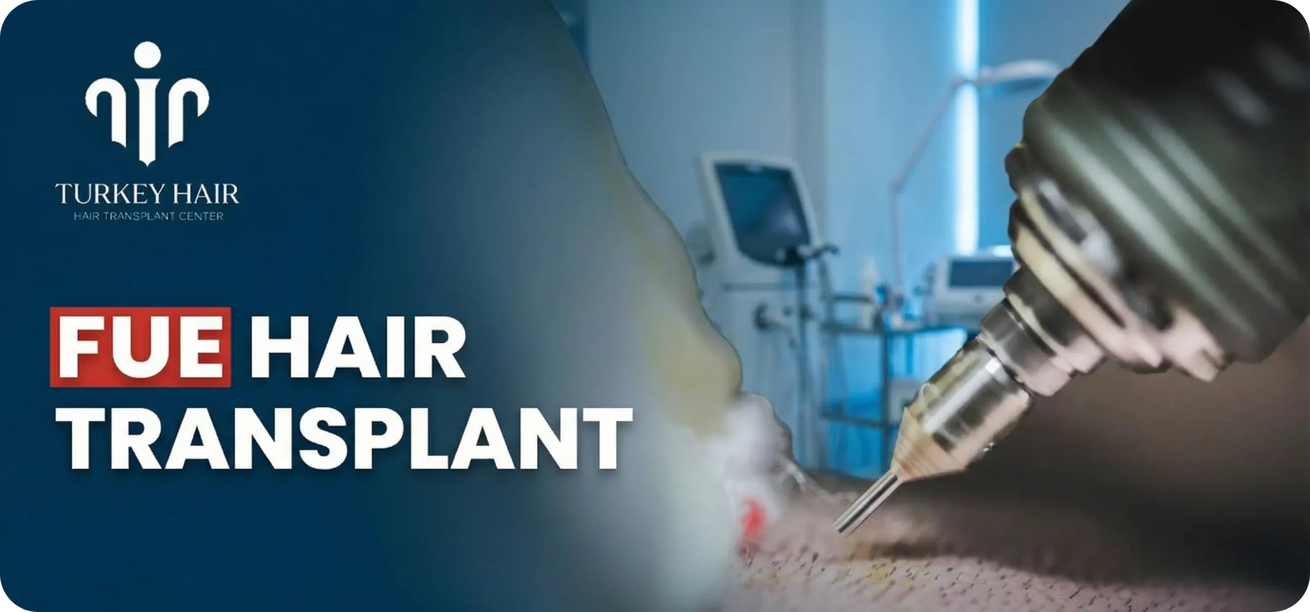 Fue Hair Transplant In Turkey – Cost, Before &Amp; After Hair Restoration Excellence You Can Trust