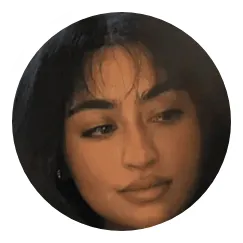 Maria  Female Hair Transplant Before And After Result