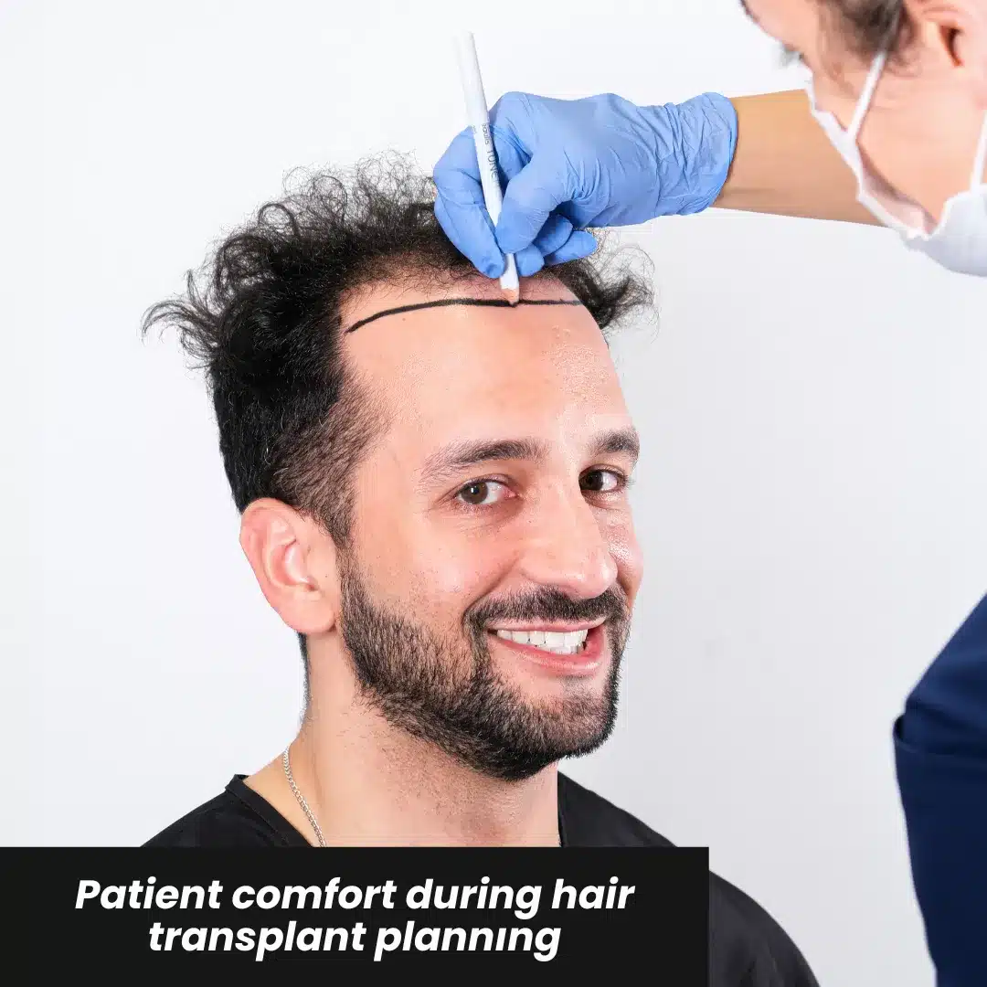 Sedated Hair Transplant