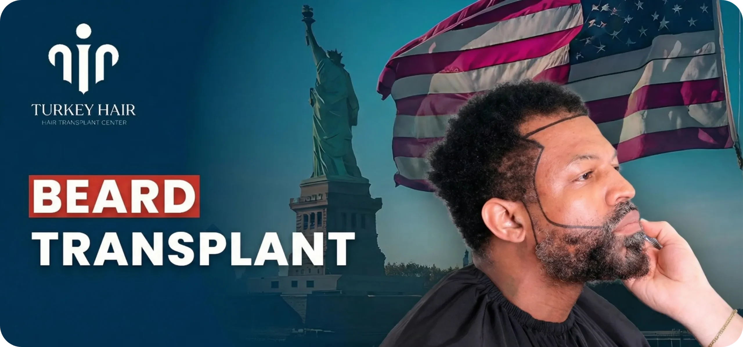 Beard Transplant In Turkey – Cost, Before And After Hair Restoration Excellence You Can Trust