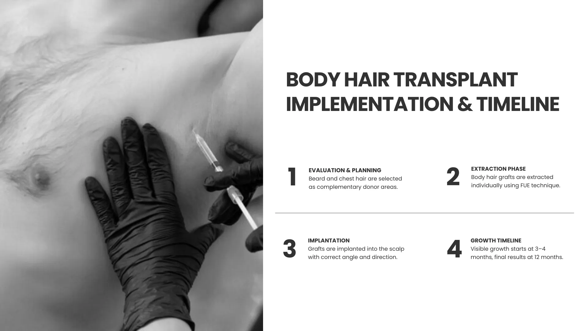 Body Hair Transplant Timeline