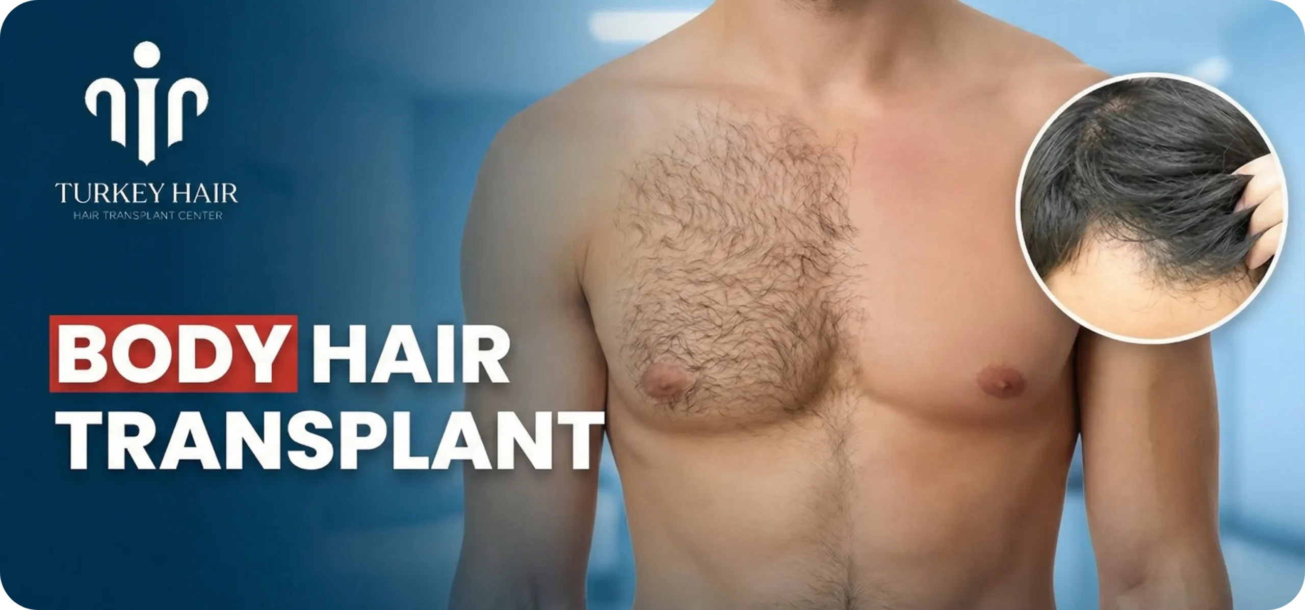 Body Hair Transplant In Turkey: Cost, Procedure &Amp; Before-After Hair Restoration Excellence You Can Trust