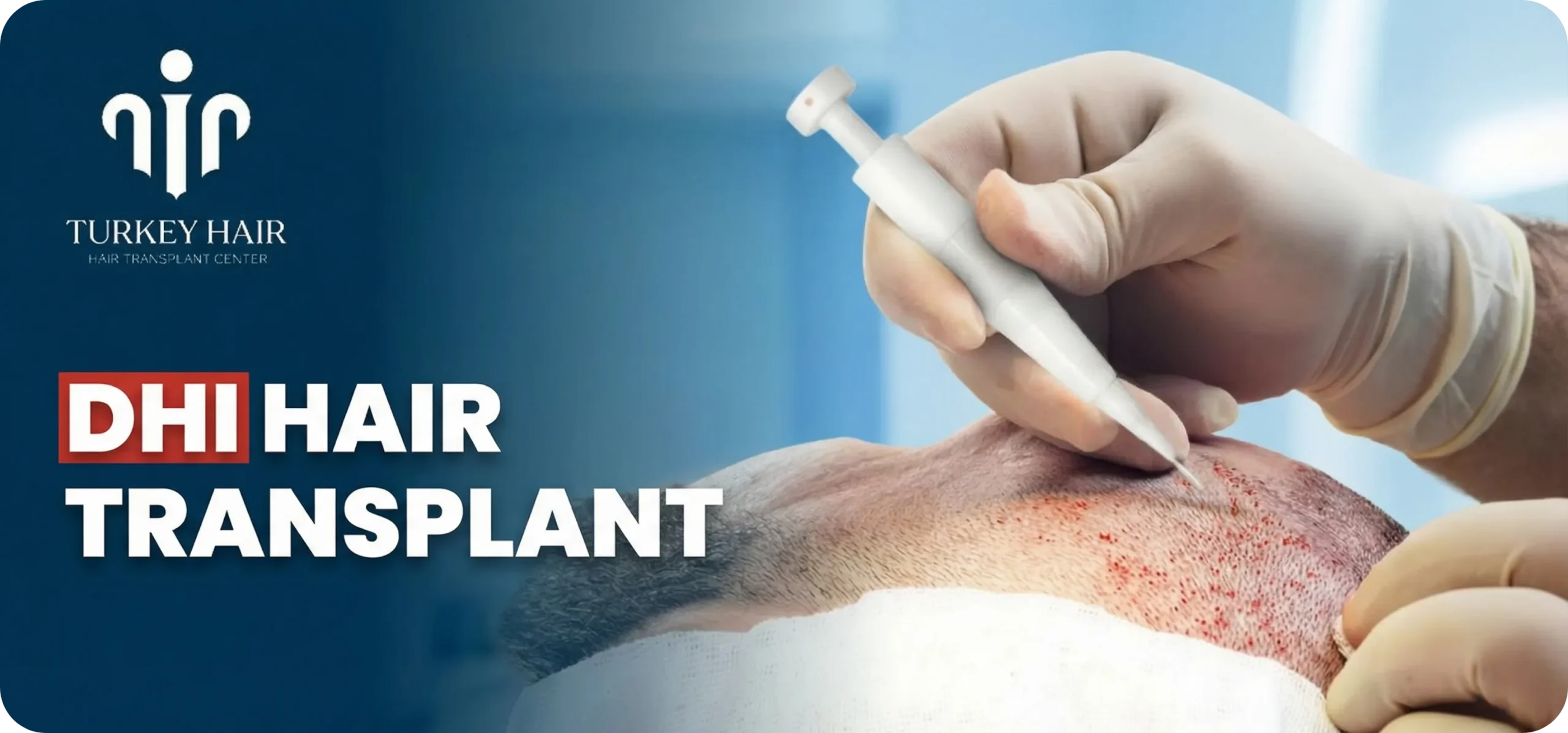 Dhi Hair Transplant In Turkey – Cost, Before &Amp; After Hair Restoration Excellence You Can Trust