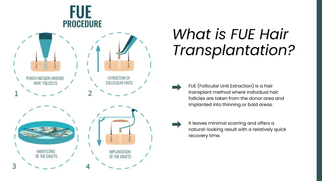 Fue Hair Transplant In Turkey – Cost, Before &Amp; After 7 Fue Hair Transplant Technique With Follicle Extraction And Implantation For Natural Hair Restoration