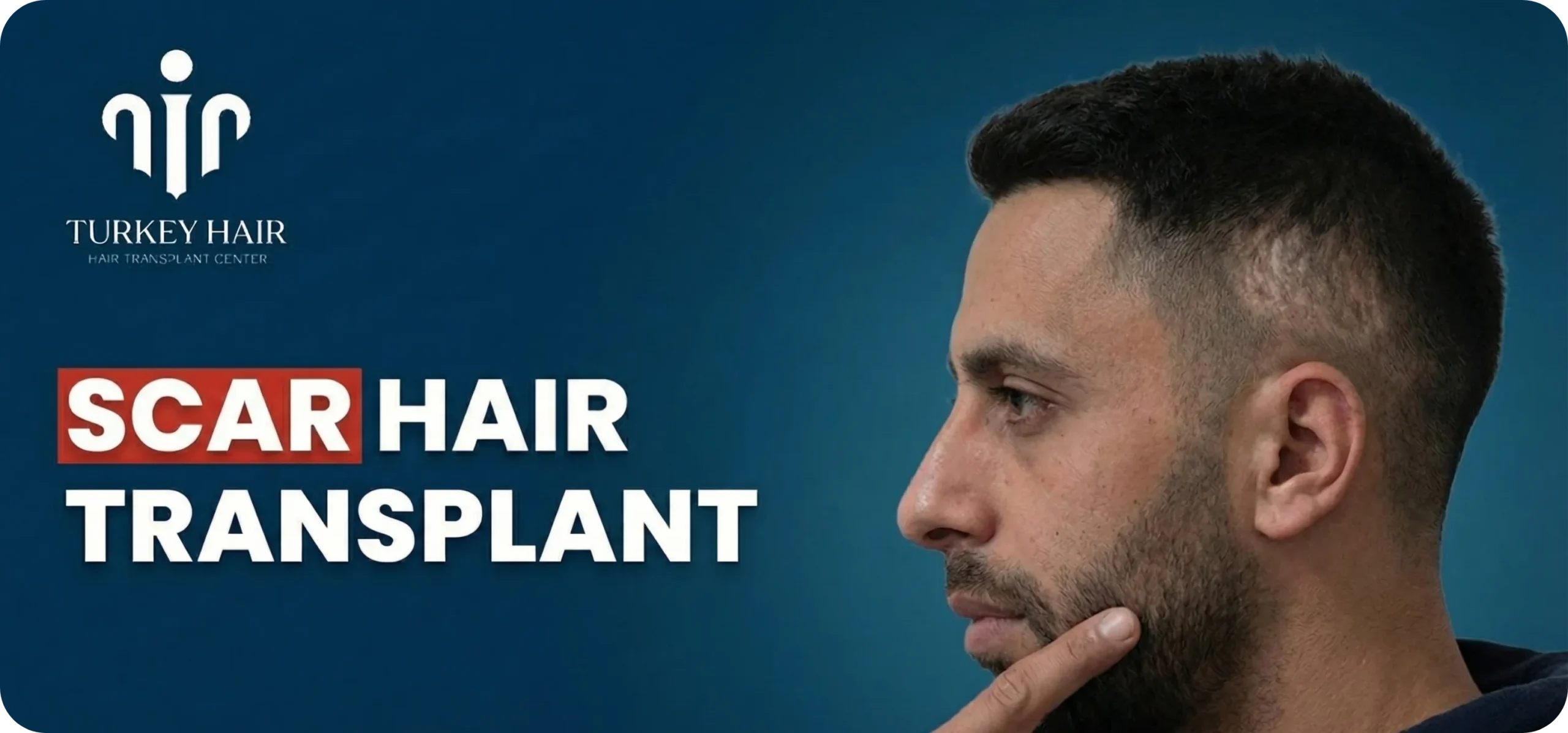 Scar Hair Transplant Hair Restoration Excellence You Can Trust