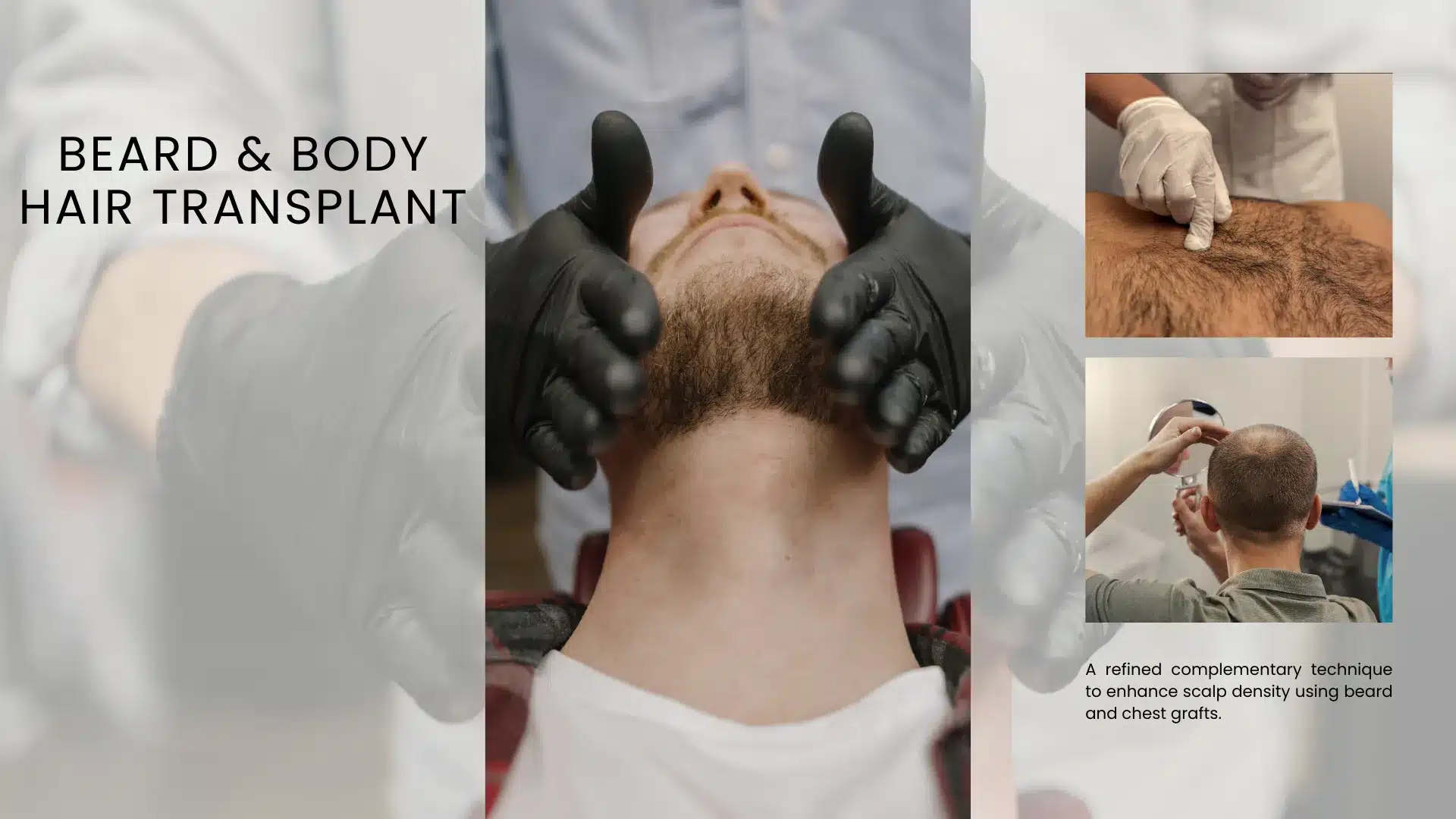 What Is Body Hair Transplant