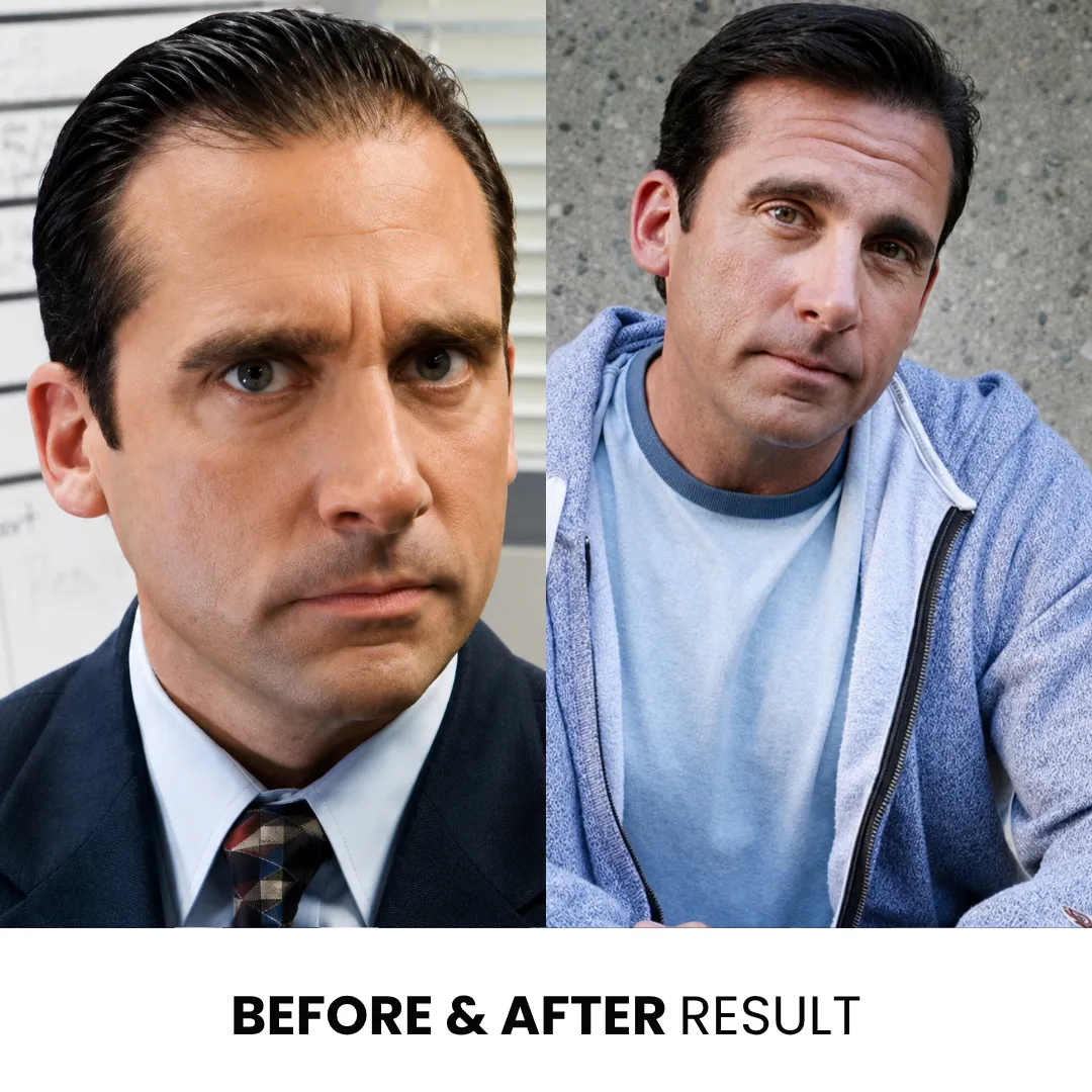 Steve Carell Before And After Hairline Result Steve Carell Before And After Hairline Comparison Showing Fuller Hair In Later Years
