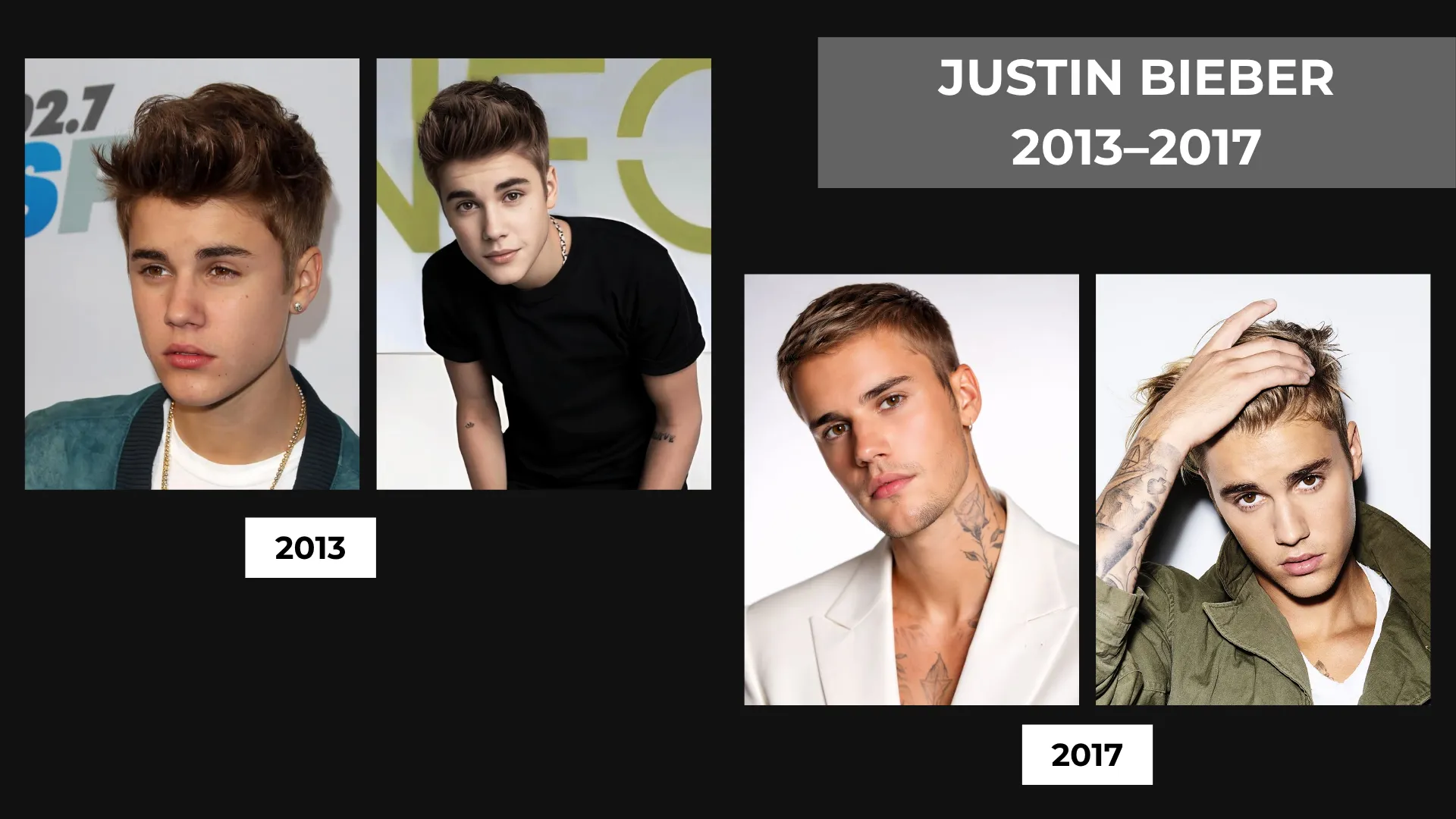 Justin Bieber 2013 and 2017 hairline comparison showing changes in hairstyle, forehead visibility, and frontal hair coverage