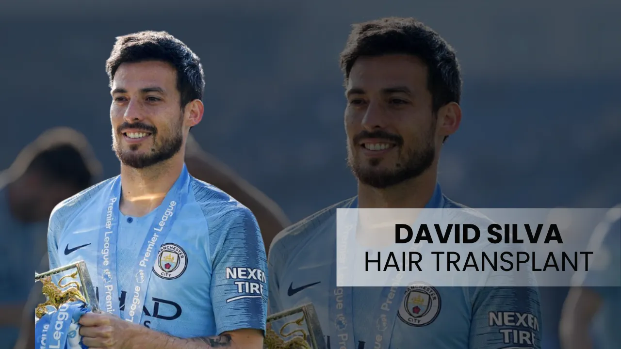 David Silva Hair Transplant: Before &Amp;Amp; After 1 David Silva Hair Transplant Cover Image Featuring Manchester City Midfielder David Silva And Hair Restoration Analysis