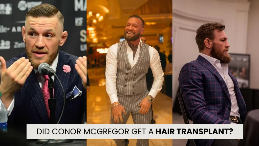 Conor Mcgregor Hair Transplant: Before &Amp; After 4 Did Conor Mcgregor Get A Hair Transplant Hairline And Density Transformation Analysis