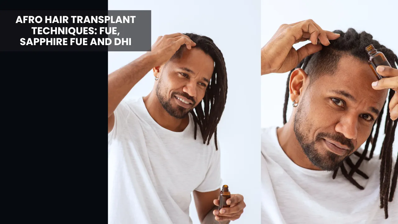 Afro Hair Transplant For Curly &Amp; Coily Hair 5 Afro Hair Transplant Techniques Using Fue, Sapphire Fue And Dhi Methods For Afro Textured Hair
