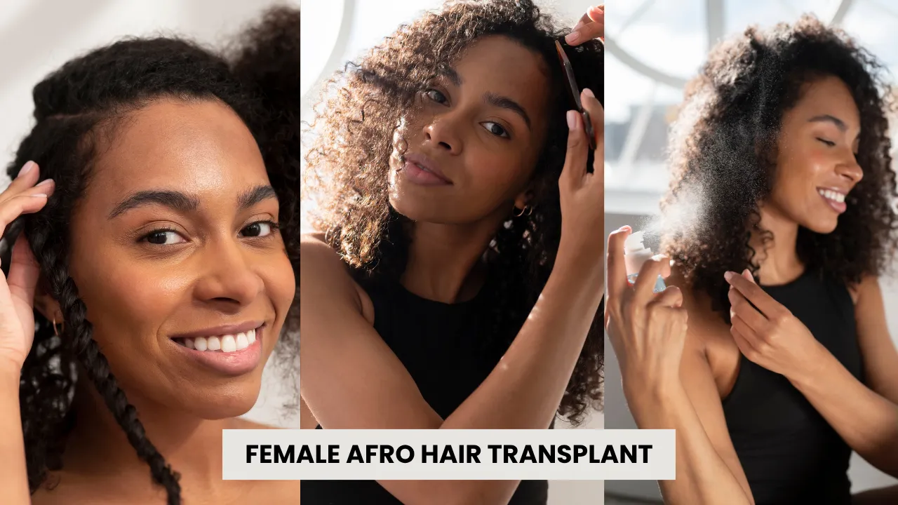 Afro Hair Transplant For Curly &Amp; Coily Hair 9 Female Afro Hair Transplant In Turkey – Natural Hair Restoration For Women With Curly And Afro-Textured Hair