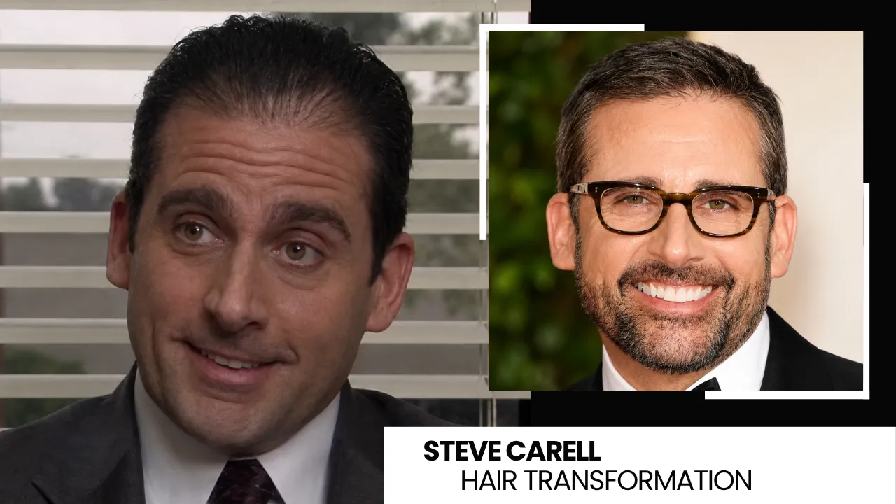 Steve Carell Hair Transplant: Before And After Hairline Analysis 1 Steve Carell Hair Transformation Before And After Comparison Showing Early Receding Hairline And Later Fuller Hair