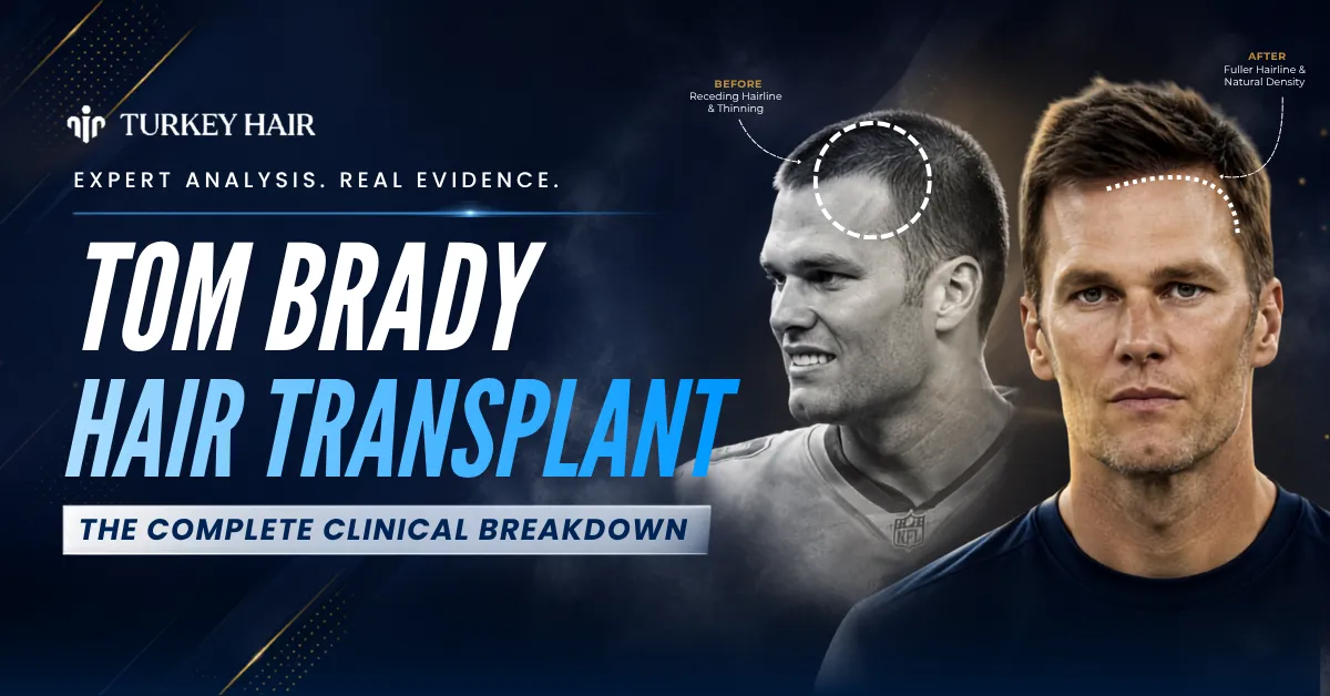 Tom Brady Hair Transplant: Before & After Photos, Hairline Analysis, Rumors vs Facts